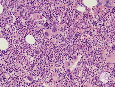 Hematoxylin-eosin-stain-bone-marrow-image.jpg