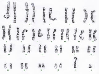 Karyotype_cr.jpg